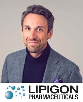 Lipigon – Stefan K Nilsson